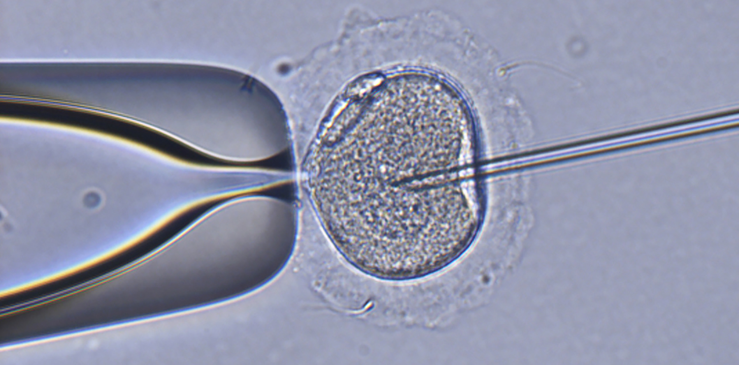 A CRISPR-Cas9 injection into a cell under the microscope