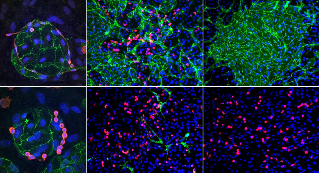 Stem cells become blood and immune cells in the Slukvin Lab