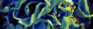 HIV-infected T cell: NIAID image.